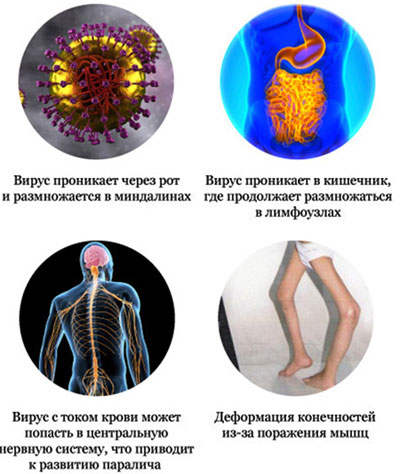 Календарь прививок в украине